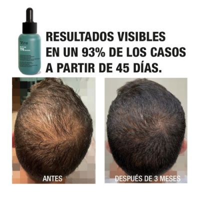 Peptid T98 proti padání vlasů (50 ml)-koncentrát TAHE